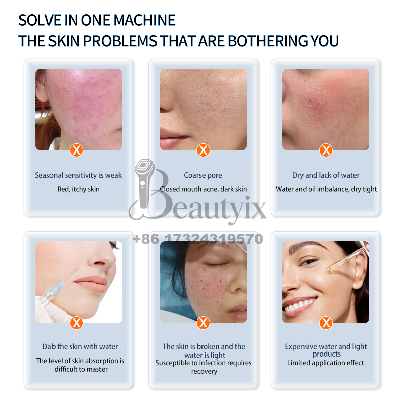 เครื่องดูแลผิวหน้ารุ่นใหม่ล่าส - Skincare Ls บทวิจารณ์และราคา